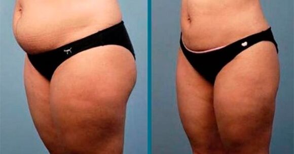 sposoby na utratę wagi o 10 kilogramów w ciągu miesiąca
